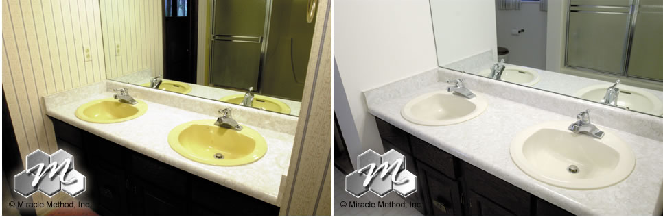 Before and After Miracle Method